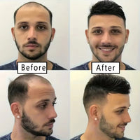 White Synthetic Wig for Men - Image 3