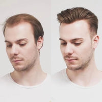 8" Straight Toupee Human Hair Wig for Men - Image 3